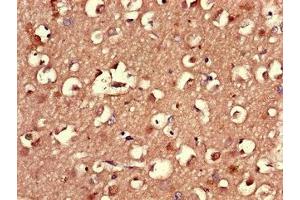 Immunohistochemistry of paraffin-embedded human brain tissue using ABIN7164558 at dilution of 1:100 (LMBRD1 Antikörper  (AA 6-100))