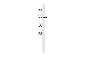 Western blot analysis in Ramos cell line lysates (35ug/lane). (MAT2A Antikörper  (N-Term))