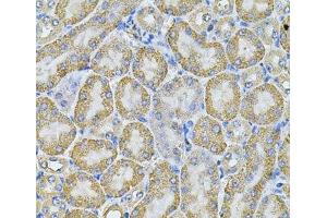 Immunohistochemistry of paraffin-embedded Mouse kidney using AP2A1 Polyclonal Antibody at dilution of 1:100 (40x lens). (alpha Adaptin Antikörper)