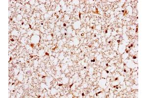 IHC image of ABIN7142091 diluted at 1:400 and staining in paraffin-embedded human brain tissue performed on a Leica BondTM system. (14-3-3 eta Antikörper  (AA 4-246))