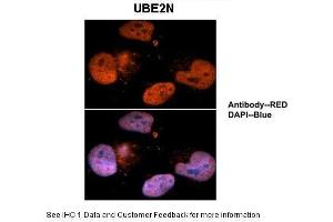 Sample Type :  Human brain stem cells  Primary Antibody Dilution :  1:500  Secondary Antibody :  Goat anti-rabbit Alexa-Fluor 594  Secondary Antibody Dilution :  1:1000  Color/Signal Descriptions :  UBE2N: Red DAPI:Blue  Gene Name :  UBE2N  Submitted by :  Dr. (UBE2N Antikörper  (Middle Region))