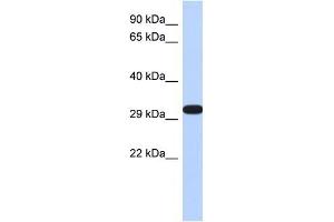 DDAH2 antibody used at 1 ug/ml to detect target protein. (DDAH2 Antikörper  (N-Term))