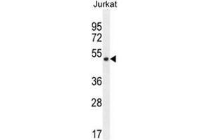 SNIP1 Antibody (N-term) western blot analysis in Jurkat cell line lysates (35µg/lane). (SNIP1 Antikörper  (N-Term))