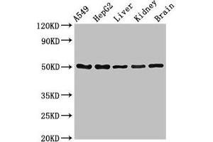 Western Blot Positive WB detected in: A549 whole cell lysate, HepG2 whole cell lysate, Mouse liver tissue, Mouse kidney tissue, Mouse brain tissue All lanes: SLC33A1 antibody at 2. (SLC33A1 Antikörper  (AA 1-74))