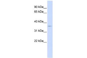 TRIB2 antibody used at 1 ug/ml to detect target protein. (TRIB2 Antikörper)