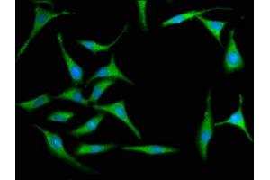 Immunofluorescence staining of Hela cells with ABIN6999591 at 1:100, counter-stained with DAPI.