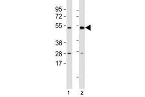 Western Blotting (WB) image for anti-Mixed Lineage Kinase Domain-Like (MLKL) (AA 444-472) antibody (ABIN3028847)