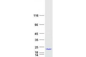 Western Blotting (WB) image for Acid Phosphatase 1, Soluble (ACP1) (Transcript Variant 3) protein (Myc-DYKDDDDK Tag) (ABIN2714334)