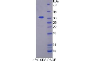 Image no. 1 for serine/threonine Kinase 3 (STK3) (AA 235-460) protein (His tag) (ABIN6238432) (STK3 Protein (AA 235-460) (His tag))