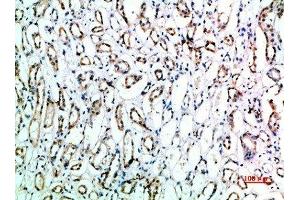 Immunohistochemical analysis of paraffin-embedded human-kidney, antibody was diluted at 1:200 (CD151 Antikörper  (AA 91-140))