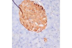 Immunohistochemistry of paraffin-embedded mouse pancreas using Phospho-ACLY-S455 antibody (ABIN6135178, ABIN6136002, ABIN6136003 and ABIN6225678) at dilution of 1:100 (40x lens). (ACLY Antikörper  (pSer455))