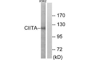Western blot analysis of extracts from K562 cells, using CIITA antibody. (CIITA Antikörper  (Internal Region))