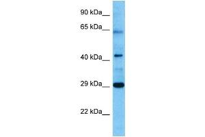 Host:  Mouse  Target Name:  VDR  Sample Tissue:  Mouse Pancreas  Antibody Dilution:  1ug/ml (Vitamin D Receptor Antikörper  (N-Term))