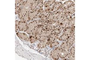 Immunohistochemical staining of human stomach with APIP polyclonal antibody  shows strong nuclear positivity in glandular cells. (APIP Antikörper)