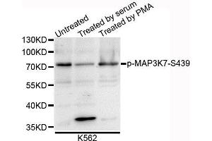 Western blot analysis of extracts of K562 cells, using Phospho-MAP3K7-S439 antibody. (MAP3K7 Antikörper  (pSer412))