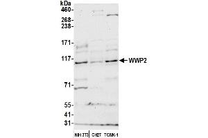 Western Blotting (WB) image for anti-WW Domain Containing E3 Ubiquitin Protein Ligase 2 (WWP2) (AA 200-250) antibody (ABIN7450909) (WWP2 Antikörper  (AA 200-250))