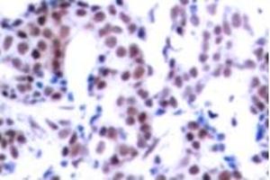 Image no. 2 for anti-Jun B Proto-Oncogene (JUNB) (pSer259) antibody (ABIN318057) (JunB Antikörper  (pSer259))
