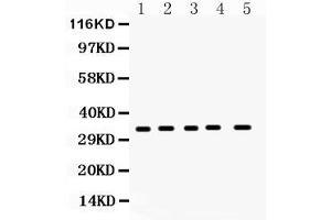 Western blot analysis of CCS expression in rat brain extract ( Lane 1), rat spleen extract ( Lane 2), mouse brain extract ( Lane 3), mouse spleen extract ( Lane 4) and 293T whole cell lysates ( Lane 5). (Superoxide dismutase copper chaperone Antikörper  (C-Term))