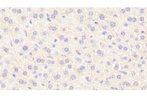 Detection of NT in Mouse Liver Tissue using Polyclonal Antibody to Neurotensin (NT) (Neurotensin Antikörper  (AA 42-167))