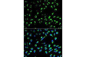 Immunofluorescence analysis of MCF-7 cells using SFN antibody. (14-3-3 sigma/SFN Antikörper)