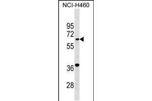 Western blot analysis in NCI-H460 cell line lysates (35ug/lane). (PET112L Antikörper  (N-Term))