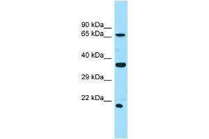 WB Suggested Anti-SLC13A1 Antibody Titration: 1. (SLC13A1 Antikörper  (N-Term))