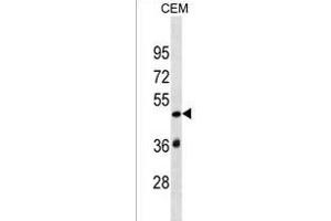 SP140L Antibody (Center) (ABIN1537899 and ABIN2849879) western blot analysis in CEM cell line lysates (35 μg/lane). (SP140L Antikörper  (AA 158-185))