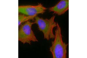 Immunofluorescence (IF) image for anti-Small Nuclear Ribonucleoprotein Polypeptide E (SNRPE) (AA 424-453) antibody (ABIN392249)
