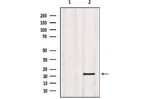 Western blot analysis of extracts from Hela, using PGRMC1 Antibody. (PGRMC1 Antikörper  (C-Term))