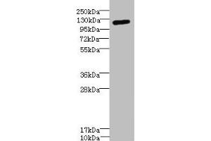 Western blot All lanes: ITGAXantibody IgG at 1. (CD11c Antikörper  (AA 100-350))