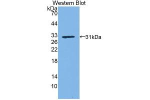 Western blot analysis of the recombinant protein. (Kallikrein 1 Antikörper  (AA 21-261))