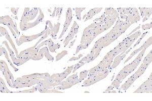 Detection of FUCa1 in Mouse Cardiac Muscle Tissue using Polyclonal Antibody to Fucosidase Alpha L1, Tissue (FUCa1) (FUCA1 Antikörper  (AA 185-447))