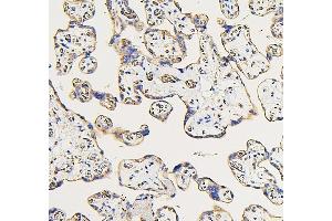 IHC analysis of IFNAR2 using anti-IFNAR2 antibody (ABIN7601353).