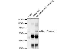 Immunoprecipitation analysis of 300 μg extracts of PC-3 cells using 3 μg Neurofilament H antibody (ABIN7268866). (NEFH Antikörper)
