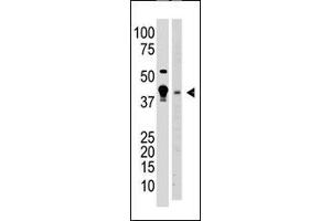 The anti-MBD2 N-term Antibody (ABIN387915 and ABIN2844333) is used in Western blot to detect MBD2 in  cell lysate (lane 1) and mouse brain tissue lysate (lane 2) lysate. (MBD2 Antikörper  (AA 120-151, AA 120-152))