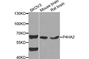 Western blot analysis of extract of various cells, using P4HA2 antibody. (P4HA2 Antikörper)