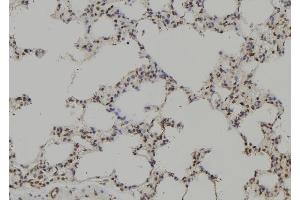 ABIN6265073 and ABIN6269204 at 1/100 staining Rat lung tissue by IHC-P. (SHP1 Antikörper  (C-Term))