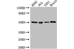 Western Blot Positive WB detected in: K562 whole cell lysate, PC-3 whole cell lysate, U251 whole cell lysate, Mouse brain tissue All lanes: TUBA1C antibody at 3 μg/mL Secondary Goat polyclonal to rabbit IgG at 1/50000 dilution Predicted band size: 50 kDa Observed band size: 50 kDa (TUBA1C Antikörper  (AA 29-184))
