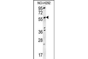 STA18 Antibody (N-term) (ABIN657881 and ABIN2846836) western blot analysis in NCI- cell line lysates (15 μg/lane). (SPATA18 Antikörper  (N-Term))