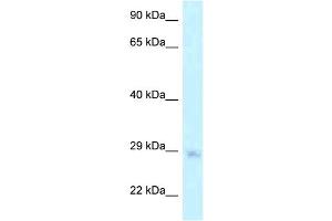 WB Suggested Anti-MTG1 Antibody Titration: 1. (MTG1 Antikörper  (Middle Region))