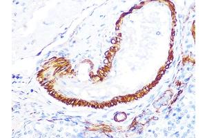 Immunohistochemistry of paraffin-embedded rat ovary using LDHB Rabbit mAb (ABIN7268170) at dilution of 1:100 (40x lens). (LDHB Antikörper)