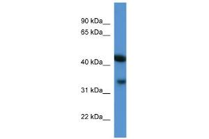 WB Suggested Anti-Centa1 Antibody Titration: 0. (ADAP1 Antikörper  (C-Term))