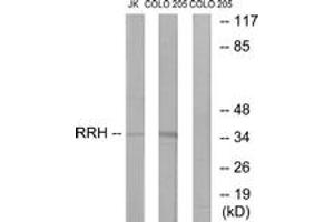 Western Blotting (WB) image for anti-Peropsin (RRH) (AA 201-250) antibody (ABIN2890958) (Peropsin Antikörper  (AA 201-250))