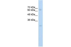 WB Suggested Anti-CES2 Antibody Titration:  0. (CES2 Antikörper  (C-Term))