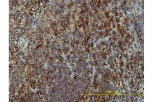 Image no. 1 for anti-Linker For Activation of T Cells (LAT) (AA 1-234) antibody (ABIN599213) (LAT Antikörper  (AA 1-234))