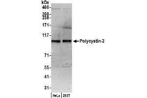 anti-Polycystic Kidney Disease 2 (Autosomal Dominant) (PKD2) (AA 918-968) antibody