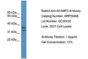 WB Suggested Anti-SCAMP3  Antibody Titration: 0.