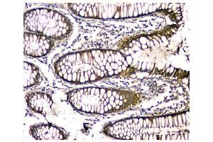 IHC analysis of CA2 using anti-CA2 antibody (ABIN6719533). (CA2 Antikörper  (AA 2-260))