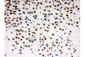Immunohistochemistry (Paraffin-embedded Sections) (IHC (p)) image for anti-Zinc Finger and BTB Domain Containing 7A (ZBTB7A) (AA 125-163), (N-Term) antibody (ABIN3044569)