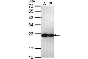 Western Blotting (WB) image for anti-Proteasome (Prosome, Macropain) Subunit, beta Type, 5 (PSMB5) (C-Term) antibody (ABIN2855902)